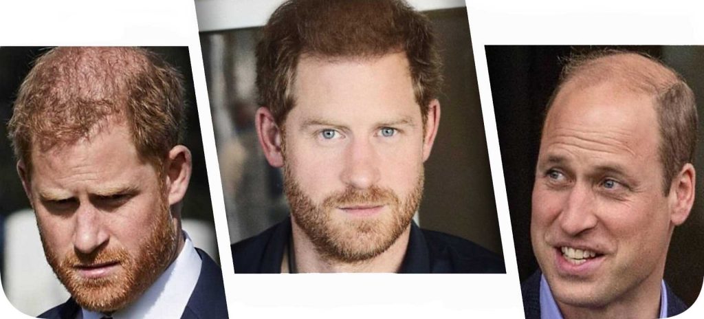 The image of Prince Harry with a suspiciously thick head of hair did not go unnoticed 1