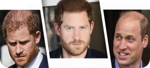 The image of Prince Harry with a suspiciously thick head of hair did not go unnoticed 9